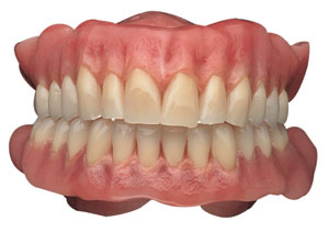 complete dentures