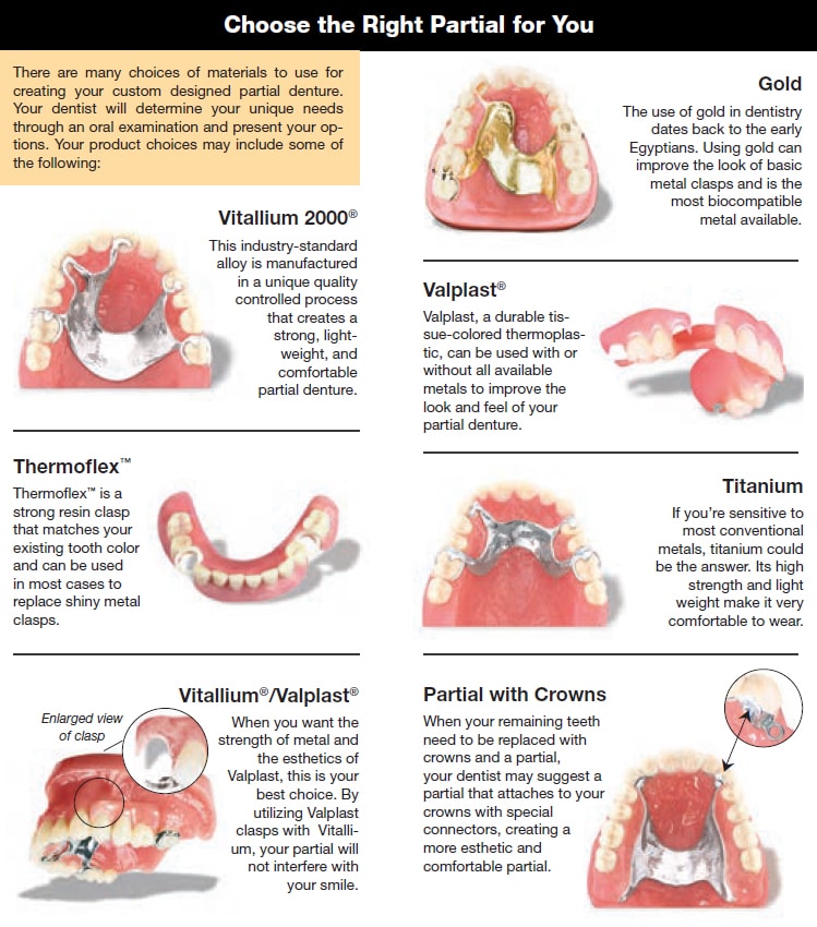 types of partial dentures